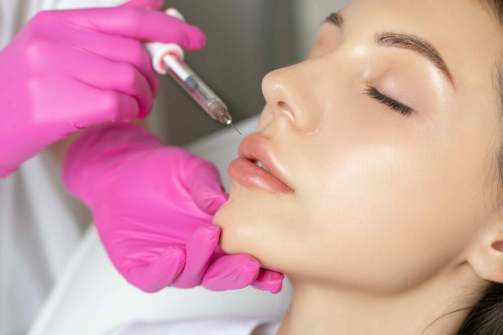 Introlift First Time Getting Lip Fillers Heres What to Expect Filler