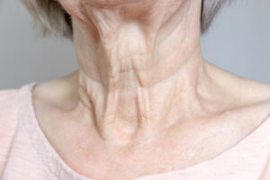 Necklift