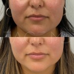Un look naturellement hydraté grâce à l'acide hyaluronique.