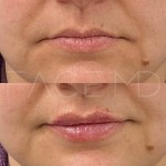 Un beau volume naturel et une bonne définition en un seul rendez-vous