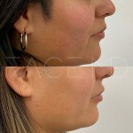 Un look naturellement hydraté grâce à l'acide hyaluronique.
