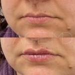 Un beau volume naturel et une bonne définition en un seul rendez-vous