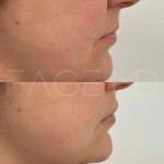 Un beau volume naturel et une bonne définition en un seul rendez-vous