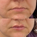 Un beau volume naturel et une bonne définition en un seul rendez-vous