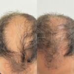 After 3 sessions we already see a great improvement !