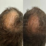 After 3 sessions we already see a great improvement !