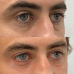 Source: Dr. Moubayed’s practice. Not a guarantee of results. Photos published with informed written consent of patients