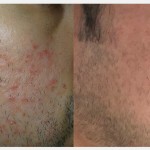 Source: Dr. Moubayed’s practice. Not a guarantee of results. Photos published with informed written consent of patients