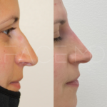 Source: Dr. Moubayed’s practice. Not a guarantee of results. Photos published with informed written consent of patients