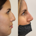Source: Dr. Moubayed’s practice. Not a guarantee of results. Photos published with informed written consent of patients